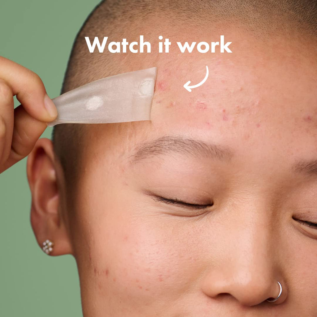 Hero Cosmetics - Mighty Patch Surface - 10 Strip(s)